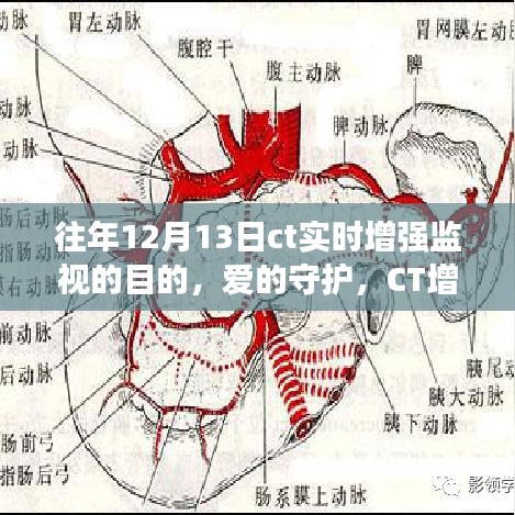 愛的守護，CT增強監(jiān)視下的暖心故事與實時增強監(jiān)視目的揭秘