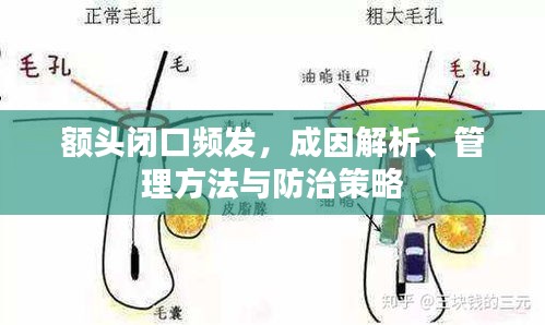 額頭閉口頻發(fā)，成因解析、管理方法與防治策略