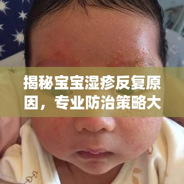 揭秘寶寶濕疹反復(fù)原因，專業(yè)防治策略大解析！
