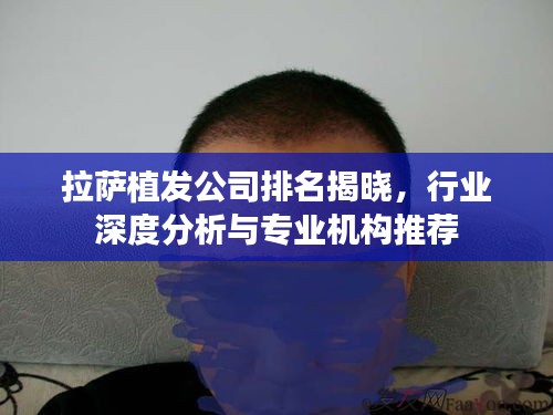 拉薩植發(fā)公司排名揭曉，行業(yè)深度分析與專業(yè)機(jī)構(gòu)推薦